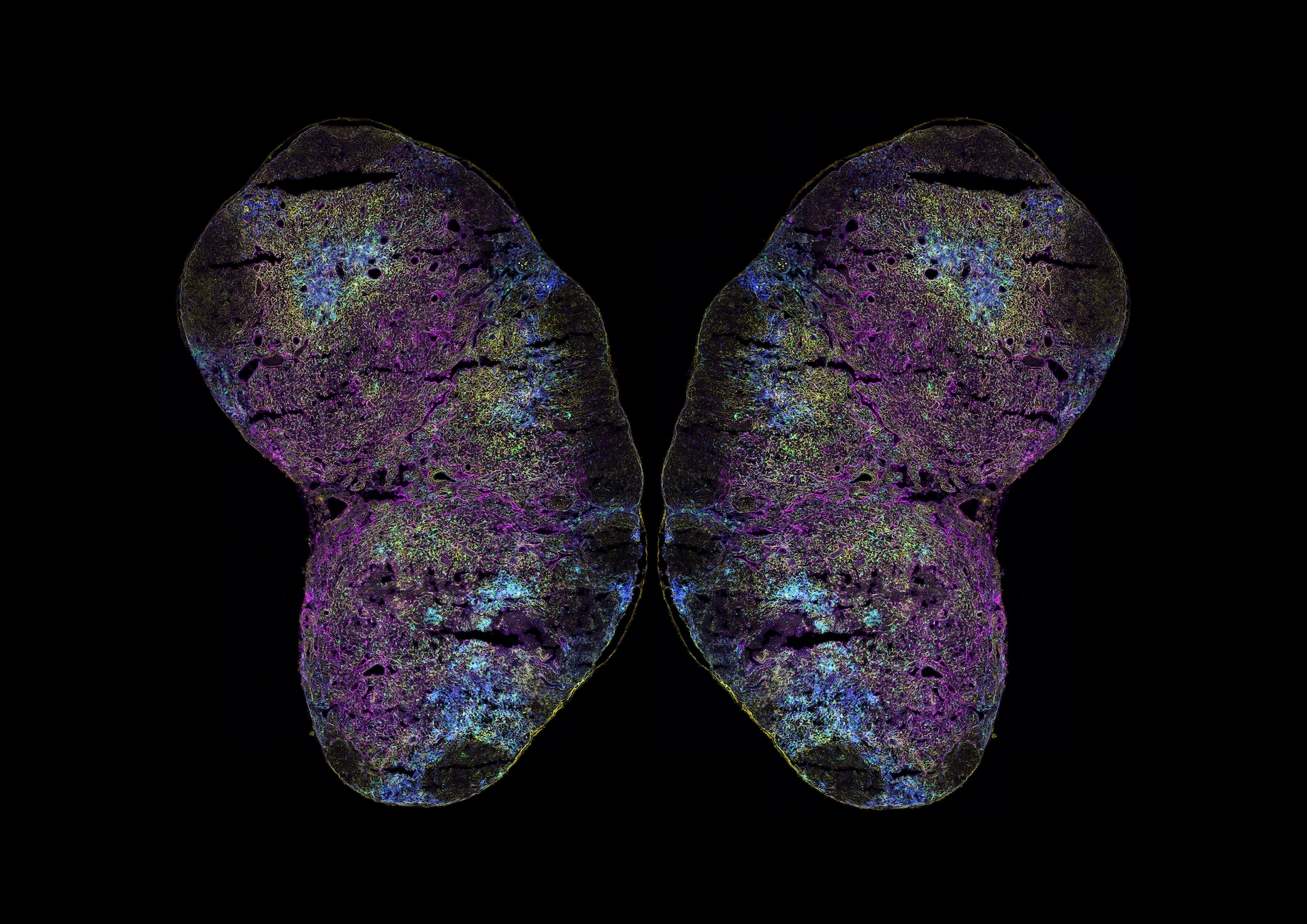 A cross section through a lymph node represented in a flower shape