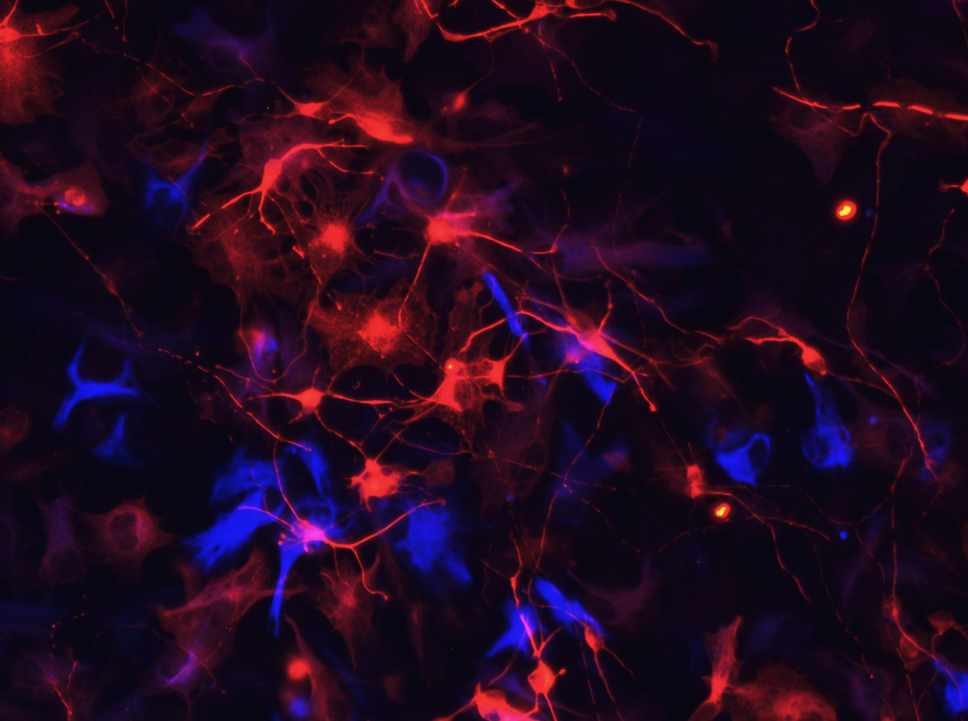 Interweb of the mind - Melody Leong's Art of Science submission