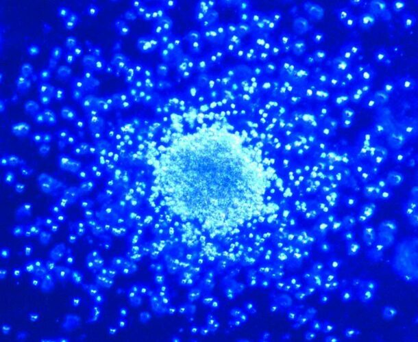 Bone marrow colonies
