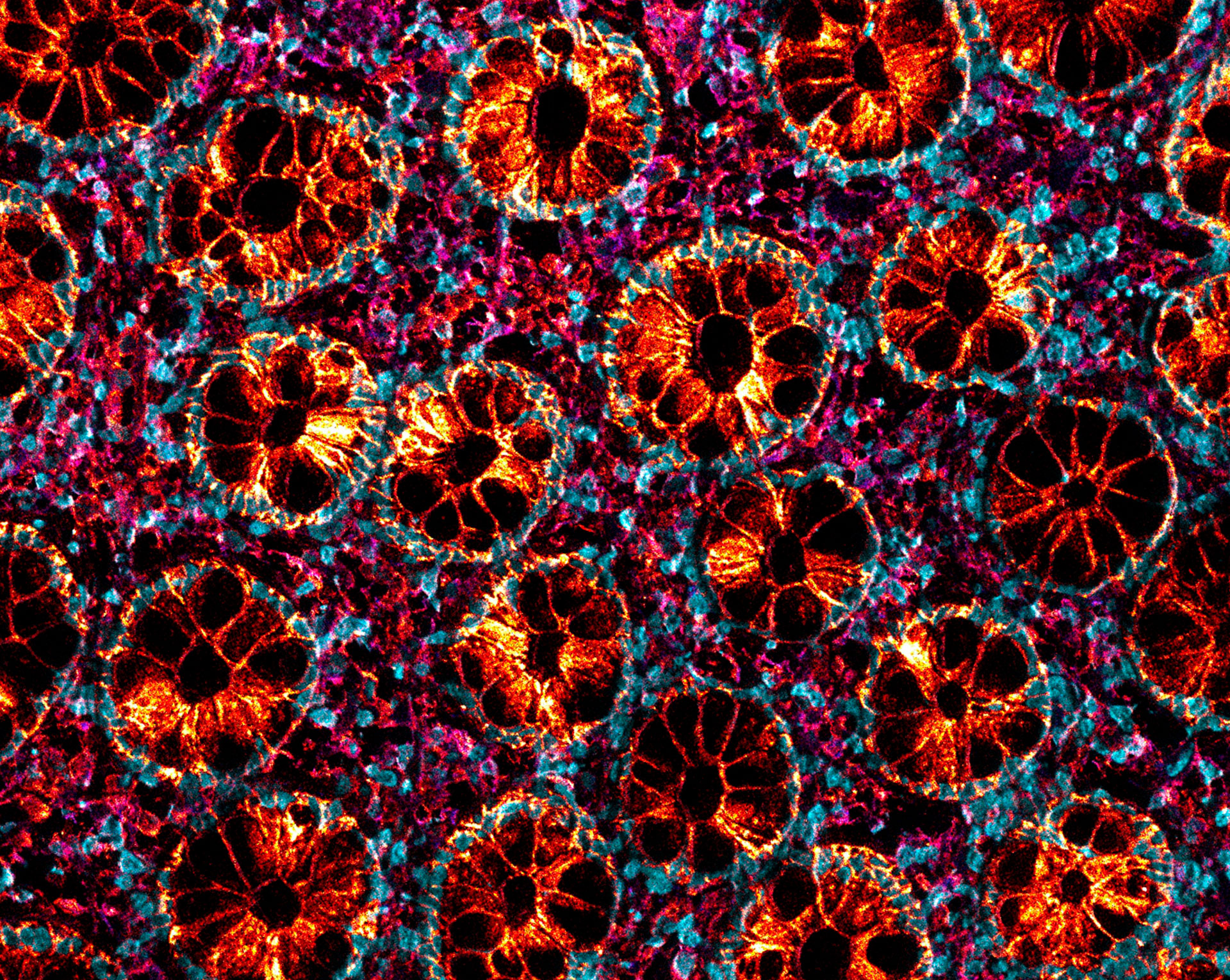 The wall of a healthy colon, with small glandular structures (crypts) lined with specialized epithelial cells that play an important role in maintaining its function.