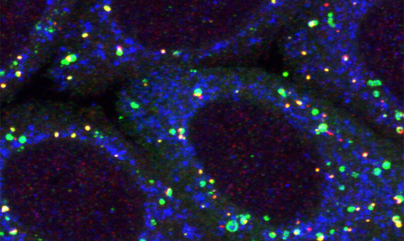 Mitochondria (blue) being targeted by mitophagy (green and red)
